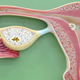 Illustration for article titled Should You Tell Your Facebook Friends Youve Had a Miscarriage?